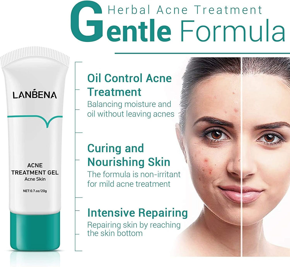 Lanbena Acne Treatment Gel