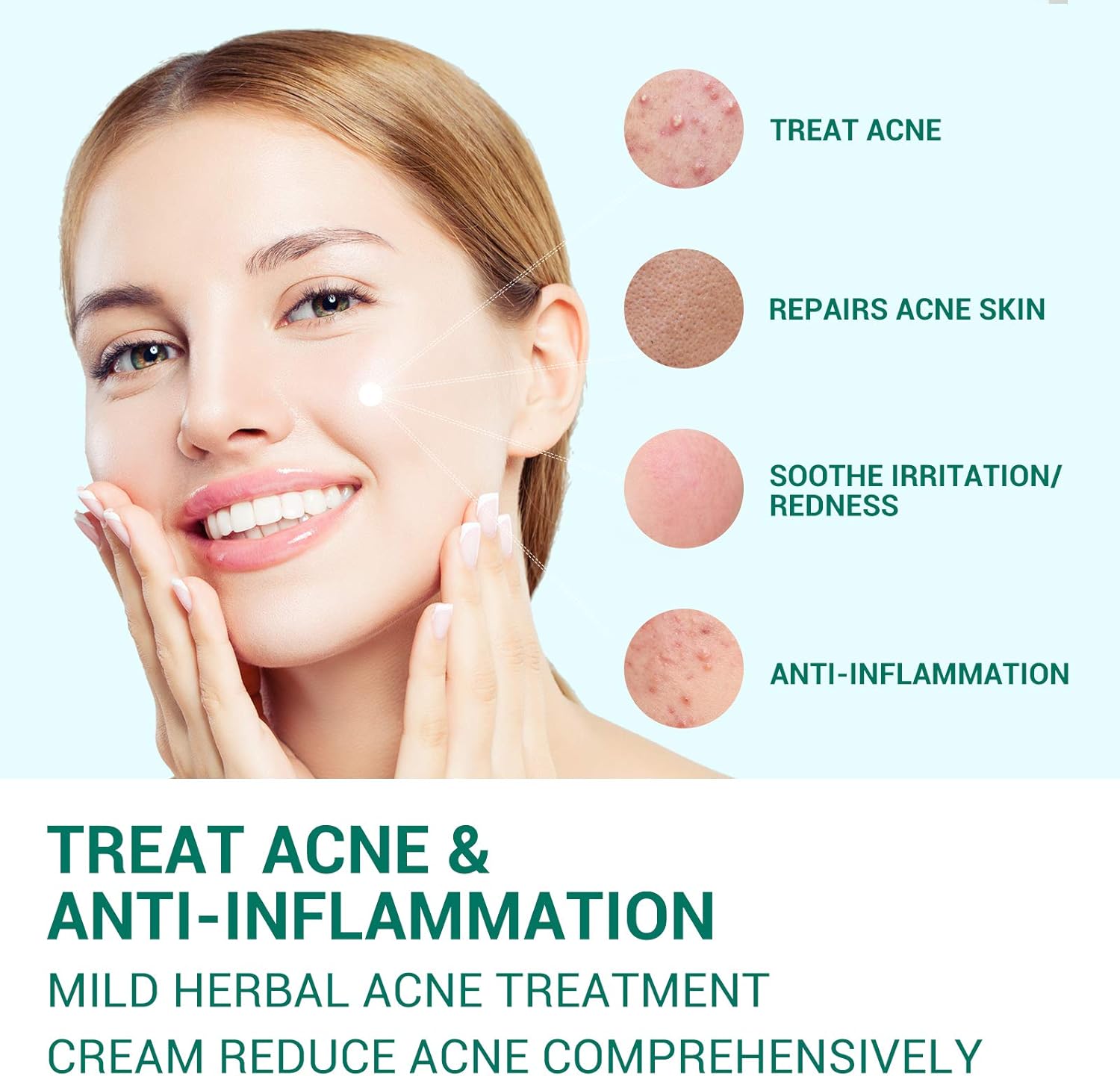 Lanbena Acne Treatment Gel