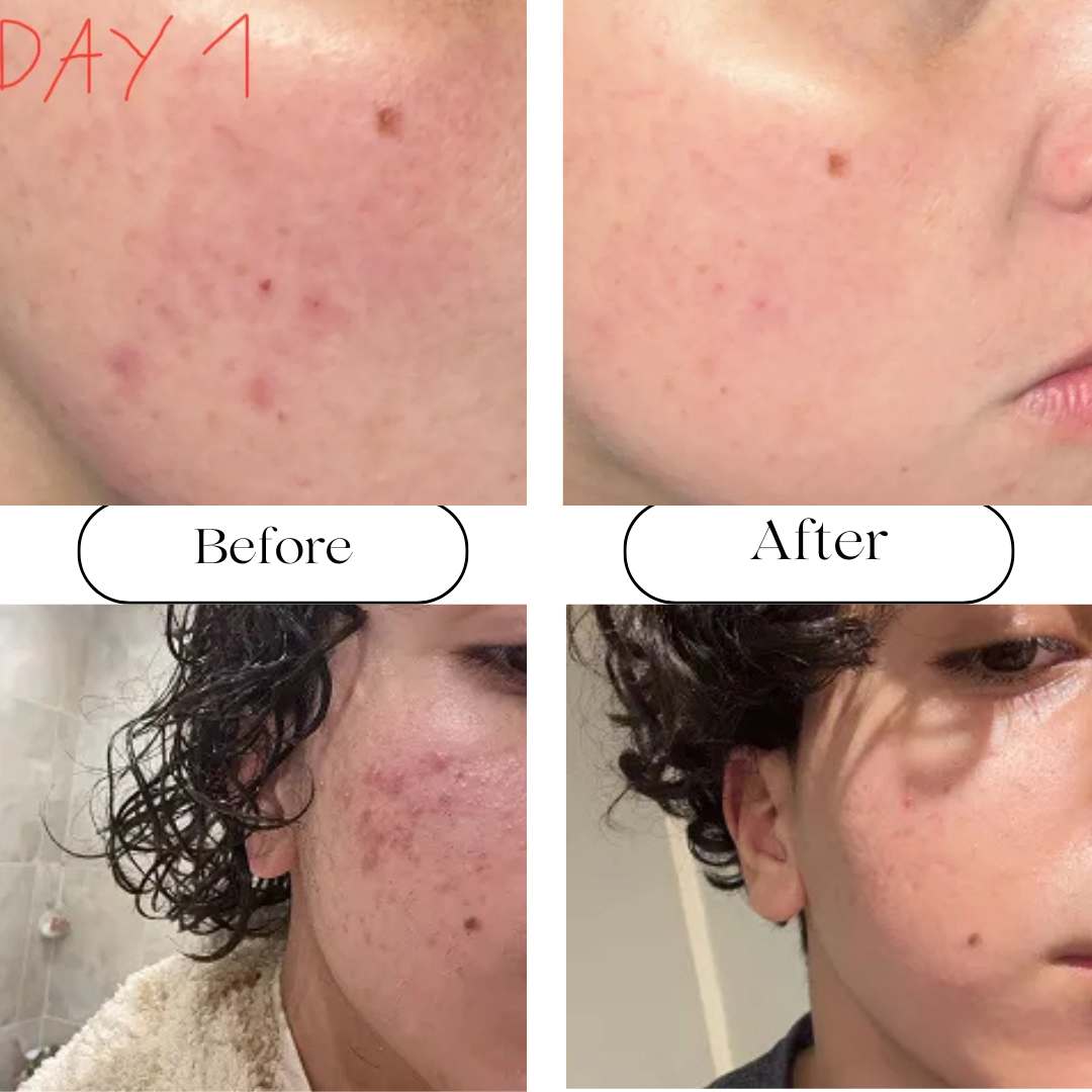 Anua Redness Soothing Serum