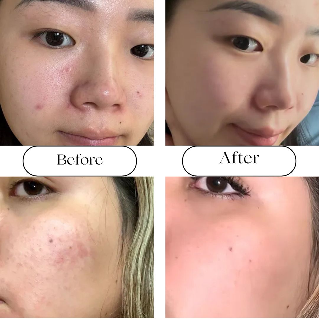 Anua Redness Soothing Serum