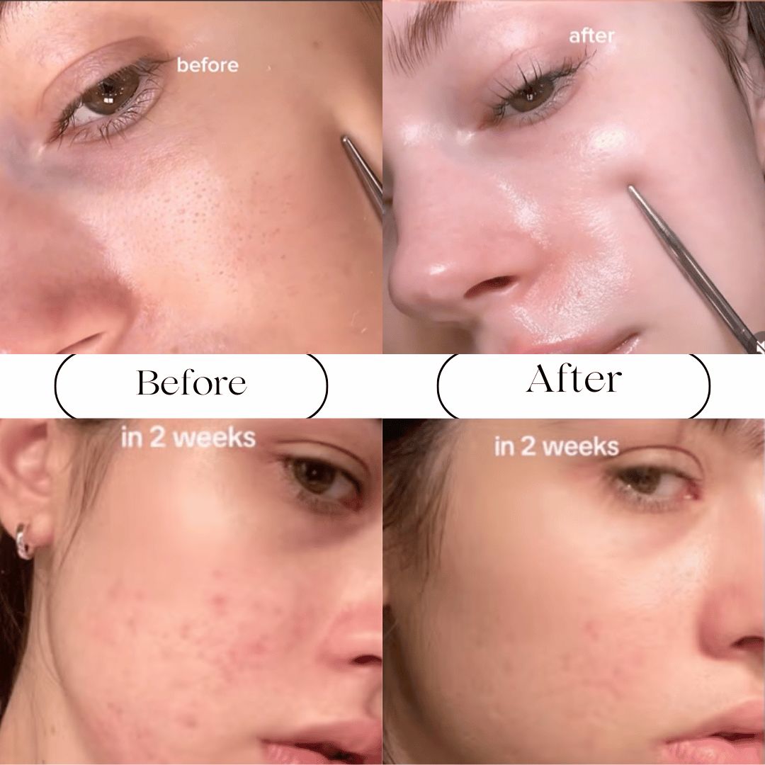 SEOUL 1988 Retinal Eye Cream