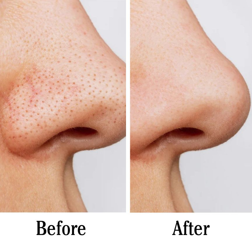 Anua Pore Control Cleasing Oil (200ML)