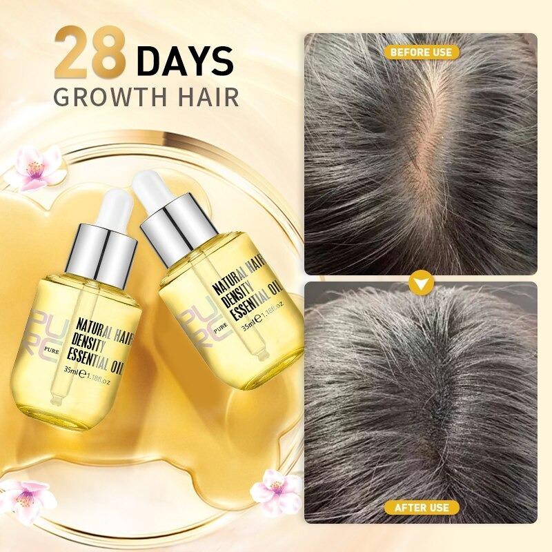 Hair Treatment For Hair Growth & Anti Hair Loss