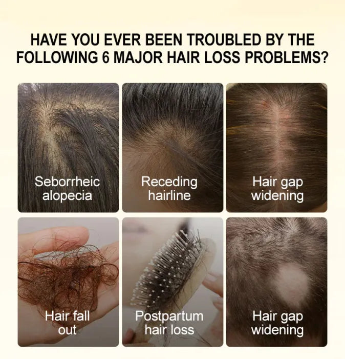 Hair Treatment For Hair Growth & Anti Hair Loss
